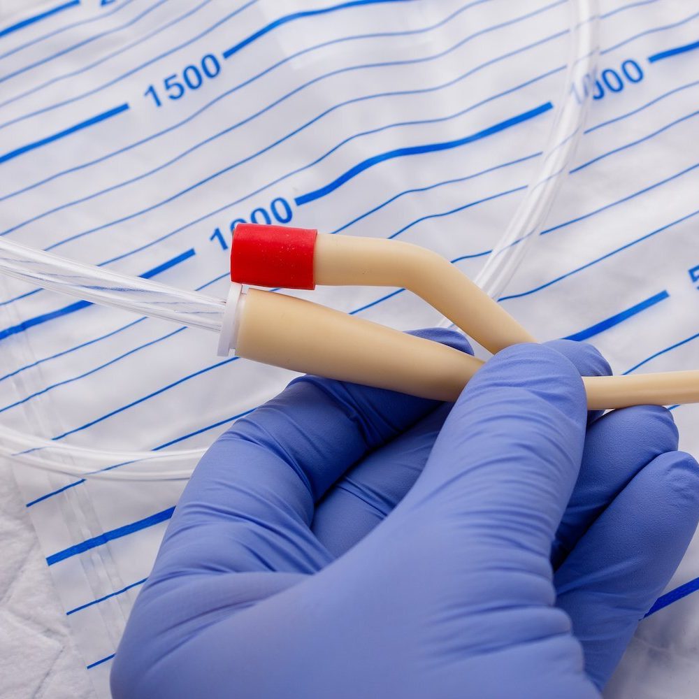 Nurse inflates urinary catheter bulb with leg drainage bag on sterile field